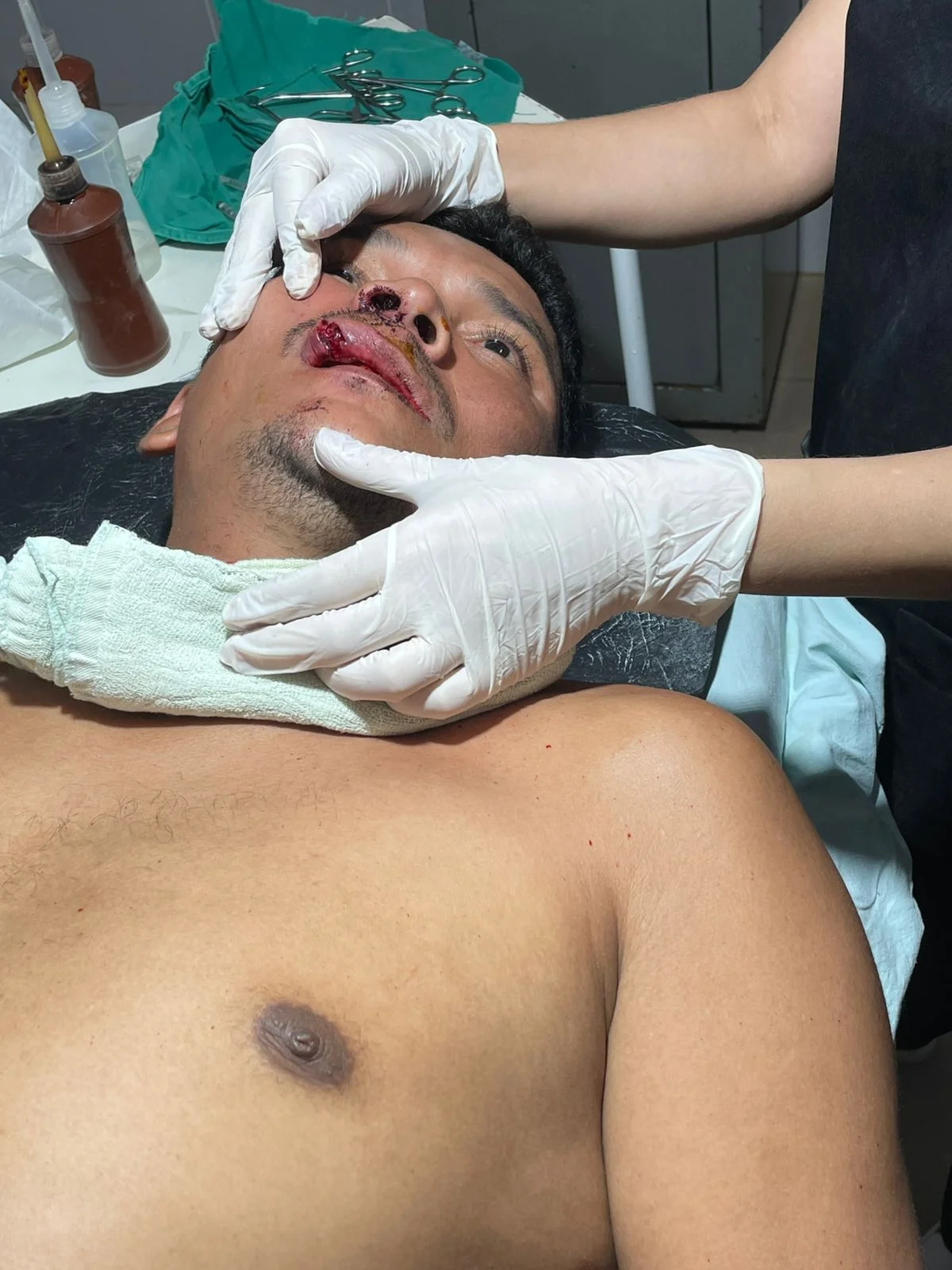 Servidor é brutalmente agredido após denunciar secretário de Limpeza Pública em Alenquer